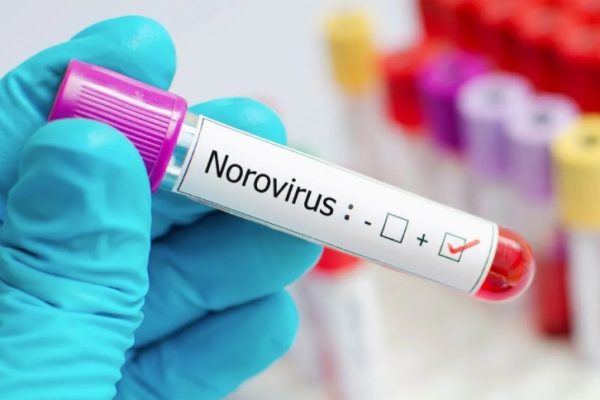 Las expectativas sobre el norovirus en 2025 y los efectos que podría causar en EEUU