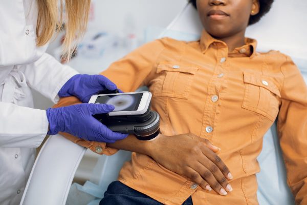 ¿Lunar o cáncer? El algoritmo que se equivoca en uno de cada tres melanomas y obvia a los pacientes con la piel oscura | Salud y bienestar EL PAÍS