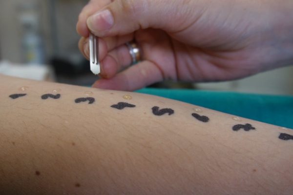 ¿Cómo se diagnostican las enfermedades alérgicas? | Salud y bienestar EL PAÍS